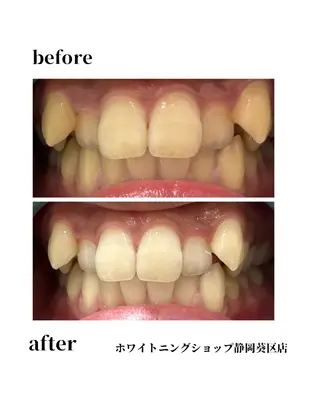 ホワイトニングショップ静岡葵区店所属・ホワイトニング ショップ葵区静岡駅店のその他イメージ