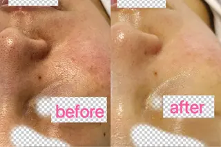 Nature Souce毛穴専門店のその他イメージ