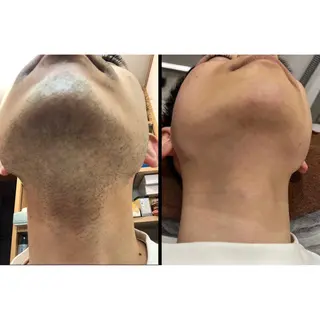 毛穴改善/脱毛 ネイル　川上久仁子のエステ・リラクイメージ