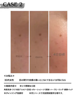 素肌育成・シミケア専門サロン美潤-miulu-所属・【医療提携サロン】 【シミケア専門】のエステ・リラクイメージ