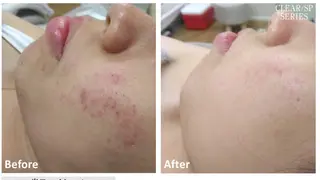 Ho-Bi エステサロンのエステ・リラクイメージ