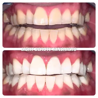 メンズ ライトビューティー 錦糸町店のエステ・リラクイメージ