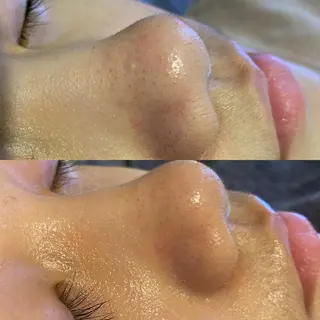 Meetite 小林のエステ・リラクイメージ