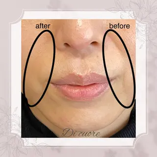 美肌フェイシャル・美肌脱毛 Di cuore所属・美肌専門 Di  cuoreのエステ・リラクイメージ