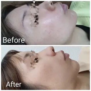 肌質改善Beauty salon Renのエステ・リラクイメージ