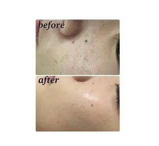 【folche】 フジイのエステ・リラクイメージ