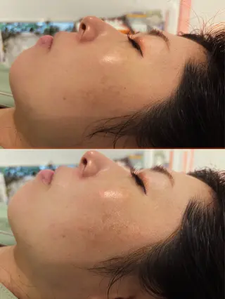 メンズ 腸活サポート みなみののエステ・リラクイメージ