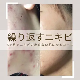 1ヶ月後も半分残る 高持続LEDエクステのマツエク・マツパデザイン