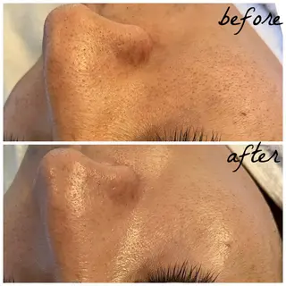 メンズ メナード岐阜市茜部 杉浦のエステ・リラクイメージ