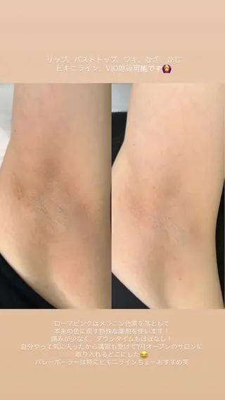 Rosée所属・Rosée南青山 ビューティーサロンのエステ・リラクイメージ