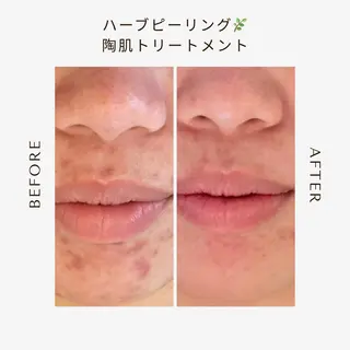 private beauty salon Lilby所属・リルビー 肌育・肌質改善サロンのその他イメージ