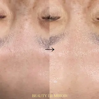 ビューティー ミロワールのエステ・リラクイメージ