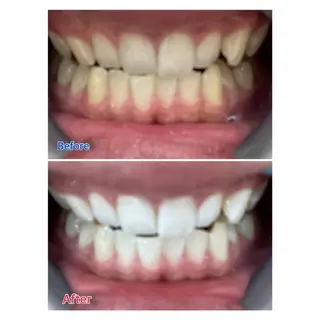 MBEAUTYSALON 千葉店・京成大久保所属・Melty 輝のその他イメージ