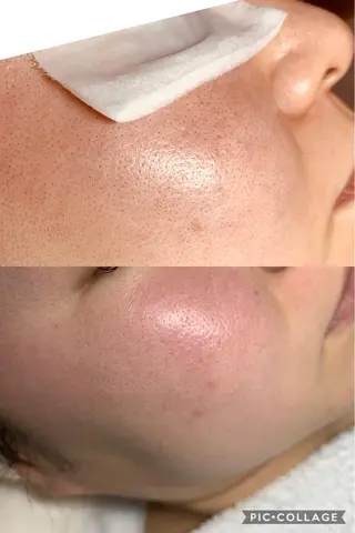 ホログラム アイラッシュ 六本木所属・エステ💎 ひろ子のエステ・リラクイメージ