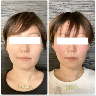 ルコナビューティ所属・小顔・歪み専門 井元 朋子のエステ・リラクイメージ