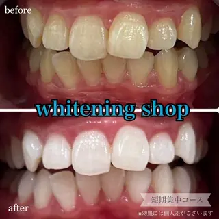 ホワイトニングショップ桜木町店所属・ホワイトニング ショップ桜木町店のエステ・リラクイメージ