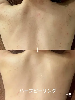 LEPUS【レプス】 sekiのエステ・リラクイメージ