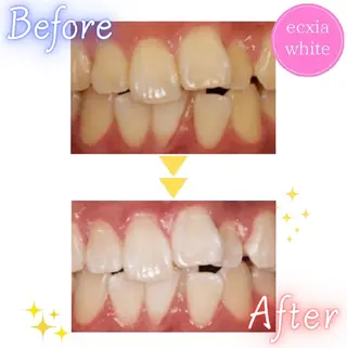 エクシアホワイトニング草津店所属・nanami -ホワイトニングのその他イメージ