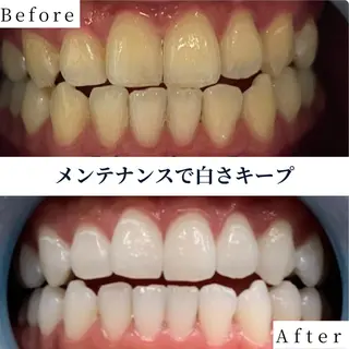 ホワイトニング ショップ南堀江のその他イメージ