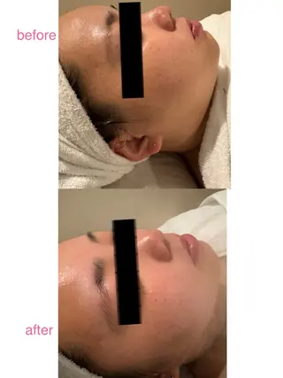 デアイム高松所属・N. Miyuのエステ・リラクイメージ