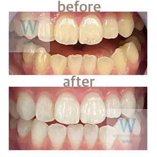 ホワイトニング ショップ船橋２号店のエステ・リラクイメージ