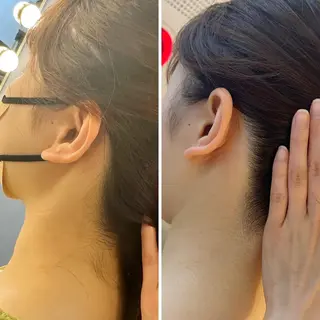 うなじ脱毛/美肌脱毛 LABELのエステ・リラクイメージ