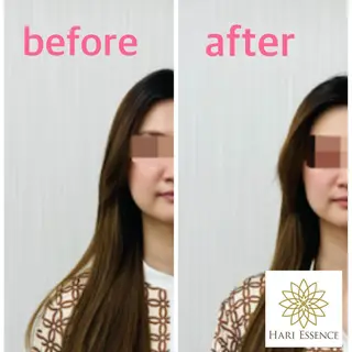 美容鍼灸専門院　ハリエッセンス所属・美容鍼専門鍼灸院 ハリエッセンスのその他イメージ