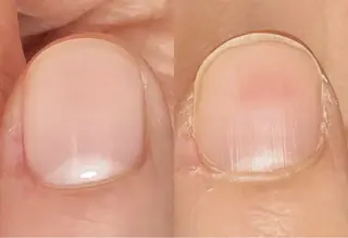 ネイル 自爪育成・ネイルケア エルメのネイルデザイン