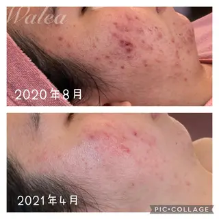 美肌蘇生カウンセラー 横山りえのエステ・リラクイメージ