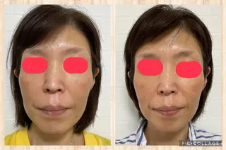 杉原 里奈のエステ・リラクイメージ