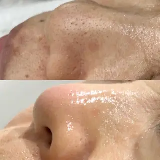 毛穴に特化したサロン MYFAIRLADYのエステ・リラクイメージ