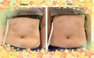 サポート鍼灸整骨院所属・サポート 鍼灸整骨院のエステ・リラクイメージ