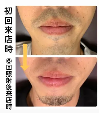 メンズ メンズ脱毛サロン Le falcoのエステ・リラクイメージ