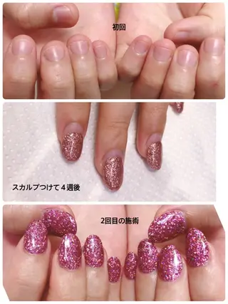 ネイル 深爪を断らない スカルプ高評価店のネイルデザイン