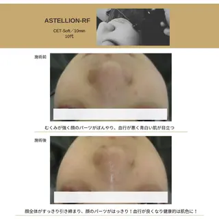 Sylphya (シルフィア)のエステ・リラクイメージ