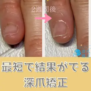 ネイル BLOOMブルーム所属・佐伯 彩菜のネイルデザイン