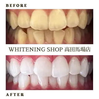 メンズ ホワイトニング ショップ高田馬場店のその他イメージ