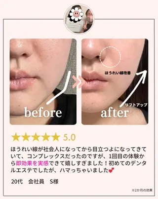 肌質改善・小顔サロン 20代店長RINNAのエステ・リラクイメージ