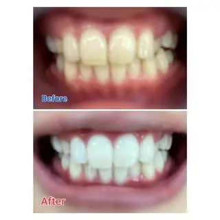 MBEAUTYSALON 千葉店・京成大久保所属・Melty 輝のその他イメージ