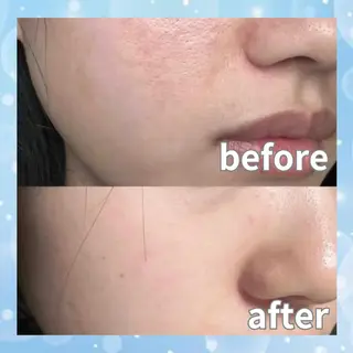 愛維美水光美肌専門店所属・愛維美水光美肌専門店 メンズレディースokのエステ・リラクイメージ