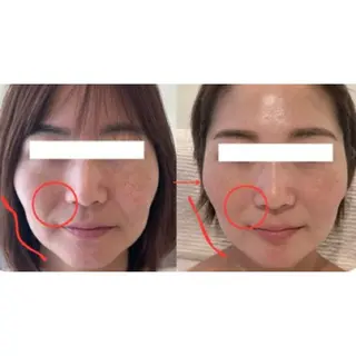 Charis エステ&ネイルのエステ・リラクイメージ