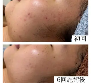 ネイル&エステ phuan(プアン)のネイルデザイン