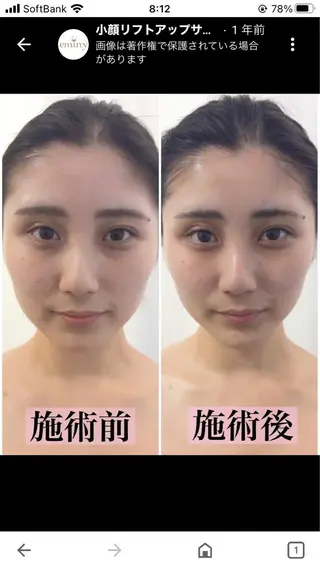 アールビューティーバランス所属・アール hirokoのエステ・リラクイメージ