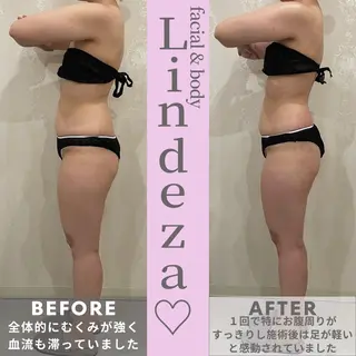 リンデザ 山口のエステ・リラクイメージ