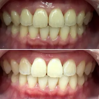 whitening salon yatto.所属・ホワイトニングサロン yatto.のその他イメージ