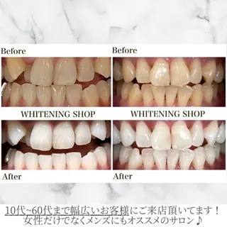 メンズ ホワイトニング ショップくずは店のエステ・リラクイメージ