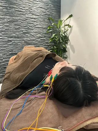 美容鍼灸整体サロンBeauJu所属・小顔矯/美容鍼/鍼灸 BeauJuのその他イメージ