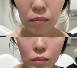 ネイル aliaハイフ&水光ジェットサロン所属・aliaハーブ水光店 エステティシャン募集のエステ・リラクイメージ