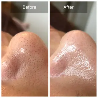 Lumiere despoir所属・Lumiere despoirのエステ・リラクイメージ