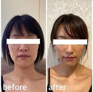 小顔コルギ＆オイル アンドエスのエステ・リラクイメージ